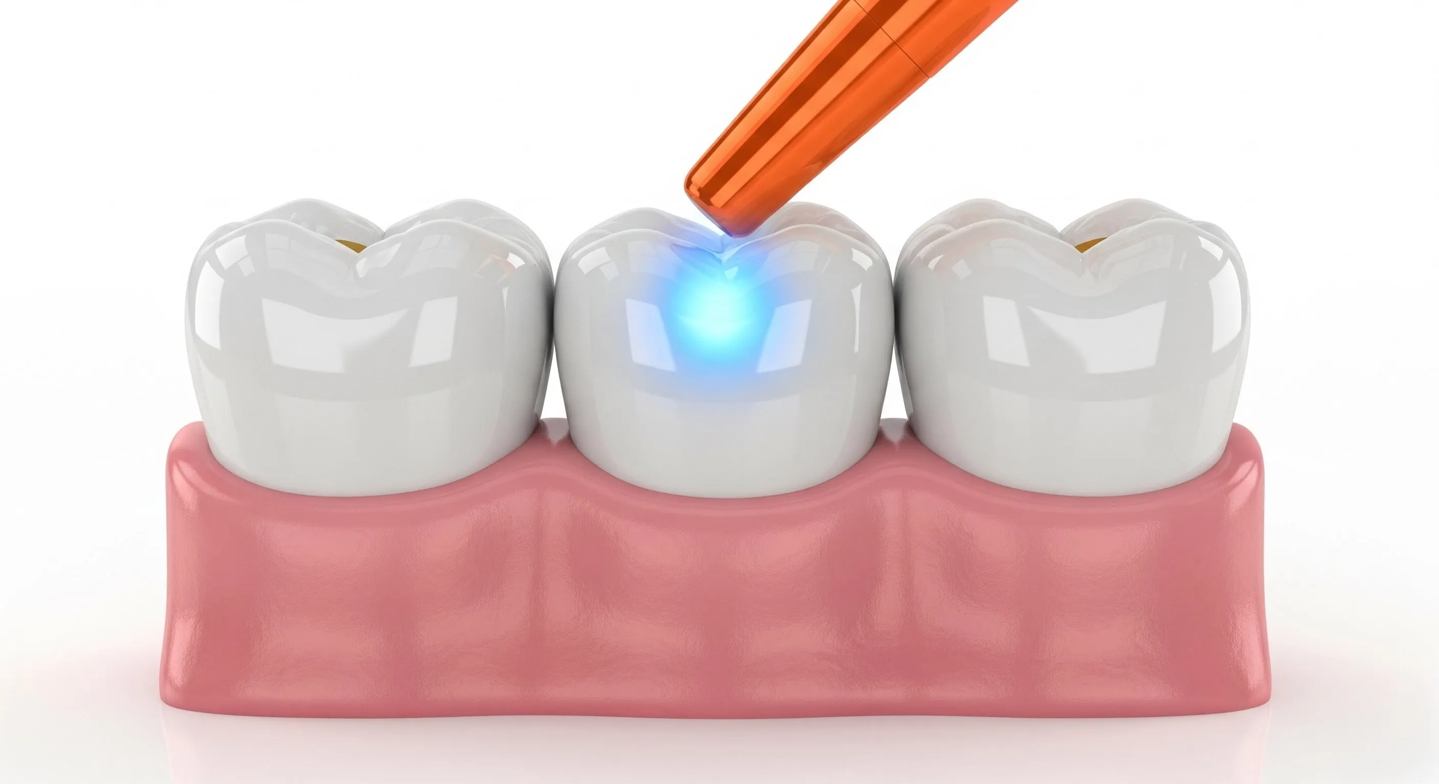 Composite Fillings Cost and Pricing Information in Vernon Hills